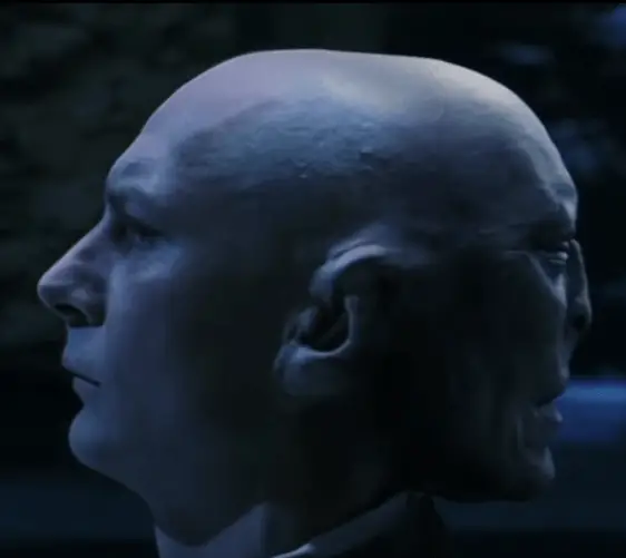 L'acteur Ian Hart qui joue Voldemort dans Harry Potter